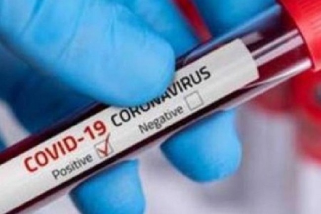 இலங்கையில் மேலும் 87 பேருக்கு கொரோனா….