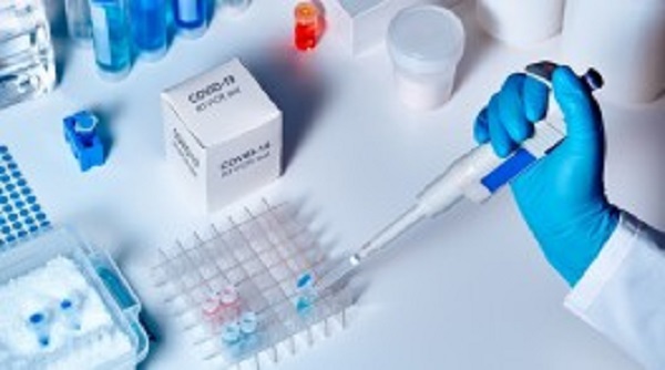 22 மில்லியன் மக்கள் தொகையில் 28 பேருக்கே PCR பரிசோதனை!