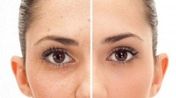 முகத்தில் அழுக்கு அதிகமா இருக்கா?