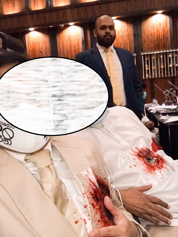 20ஆவது திருத்த முடிவால் துப்பாக்கி சூட்டு காயத்துடன் சஜித் அணி ..!!