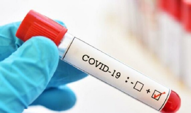 மரக்கரி மொத்த விற்பனை நிலையத்தில் எவருக்கும் கொரனா தொற்று இல்லை… வெளியான முக்கிய தகவல்