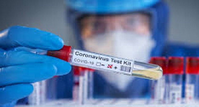 வவுனியாவில் 7 பேருக்கு கொரோனா தொற்று!