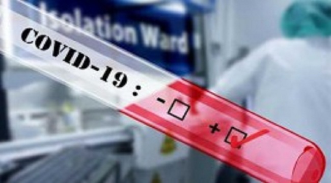 நானுஓயாவில் யுவதி ஒருவருக்கு கொரோனா….