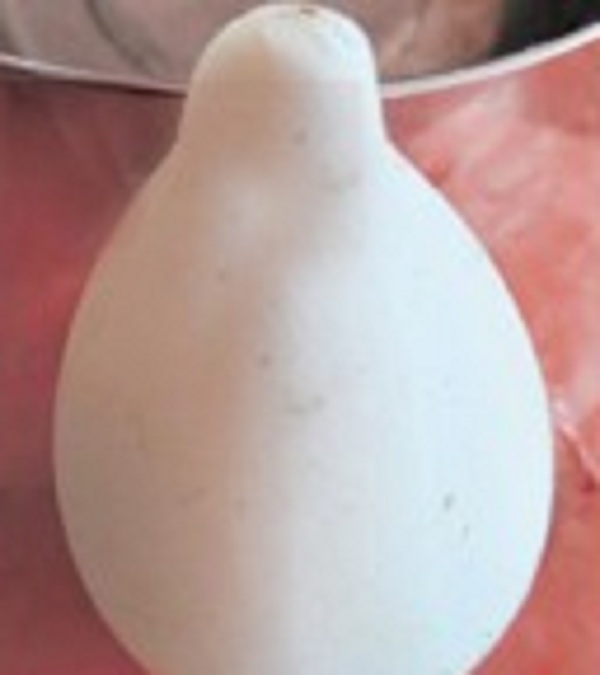 விசித்திரமான கோழி முட்டை ஒன்று கண்டுபிடிப்பு!