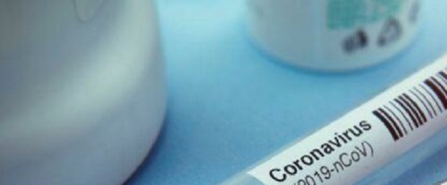 யாழ். பல்கலைகழக மாணவனிற்கும் கொரோனா!