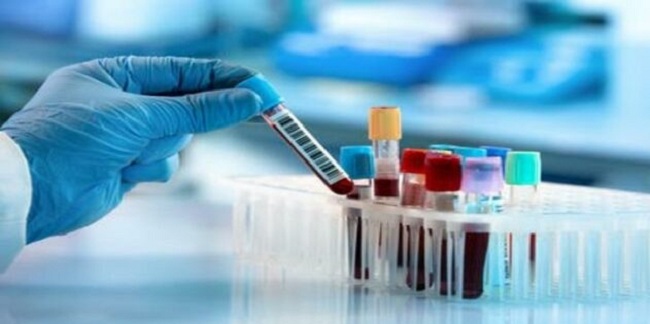 நாட்டில் நேற்று 515 கொரோனா நோயாளர்கள் அடையாளம்