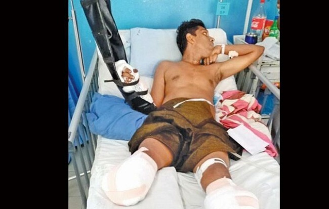 பொலிசாருக்கு தகவல் வழங்கியதற்காக காலை வெட்டியெடுத்து சென்ற ரௌடி….