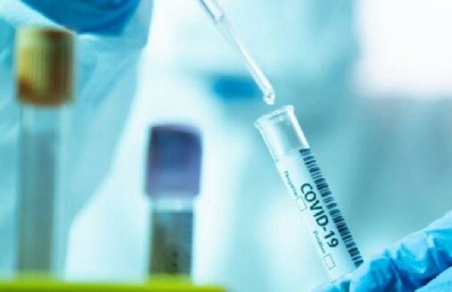 நாட்டில் நேற்று 588 கொரோனா தொற்றாளர்கள்!