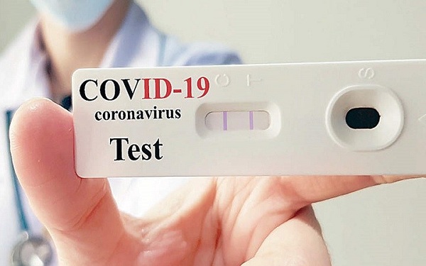 நாட்டில் மேற்கொள்ளப்படும் அன்டிஜன் பரிசோதனைகள் – இதுவரையில் 103 நோயாளர்கள் அடையாளம்!