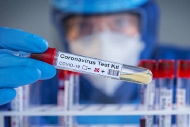 கல்வித் திணைக்கள நிர்வாக பிரினருக்கு உறுதியானது கொரோனா….