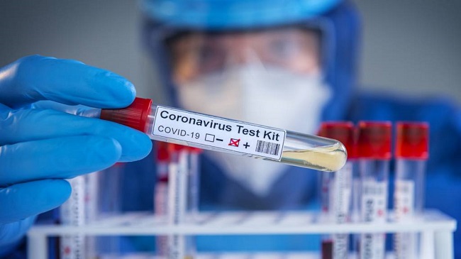 இலங்கையில் நேற்று 942 தொற்றாளர்கள்!