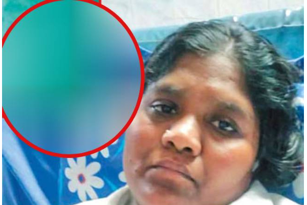 வலியால் துடித்த பெண்ணை பரிசோதித்த டாக்டர்களுக்கு காத்திருந்த அதிர்ச்சி ! 12 வருடங்களாக வயிற்றில் இருந்த பொருள்