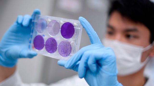 நாட்டில் பரவும் ஆபத்தான வைரஸ் திரிபுகள்! இன்று ஆரம்பமாகும் பரிசோதனை