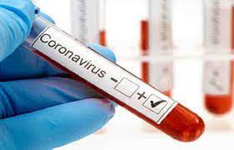 கைதடி அரச முதியோர் இல்லத்தில் பராமரிக்கப்படும் 41 பேருக்கு கோவிட் உறுதி!