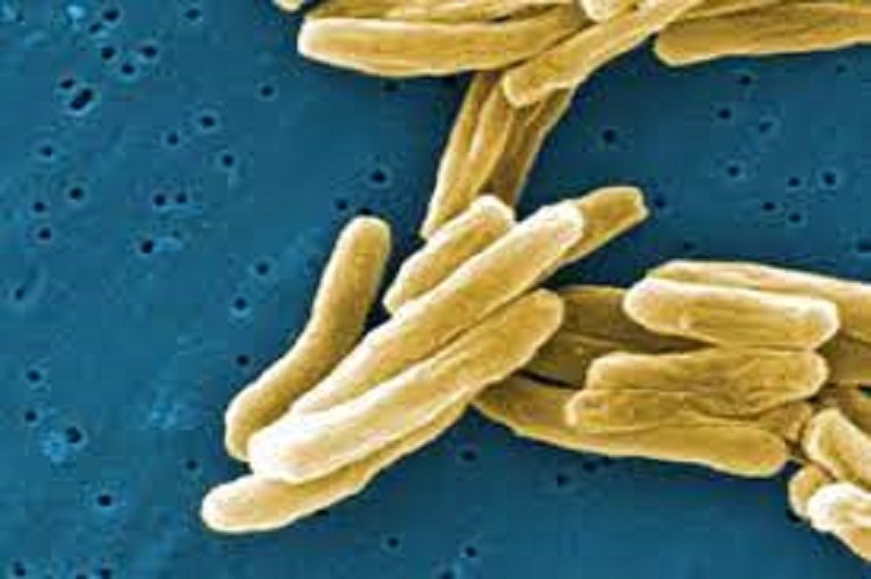 கனடாவில் புதிதாக பரவும் காசநோய்