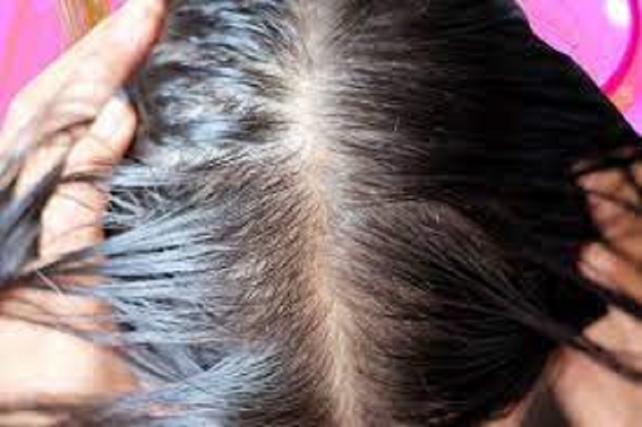 அளவுக்கு அதிகமா தலைமுடி வளரணுமா?