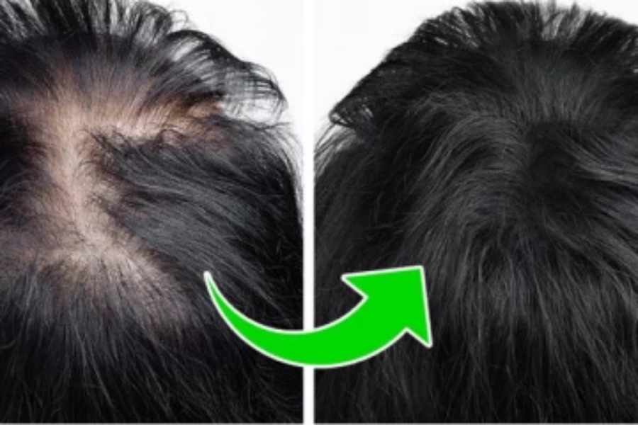 உங்கள் தலைமுடி நன்கு அடர்த்தியாக வளர வேண்டுமா?