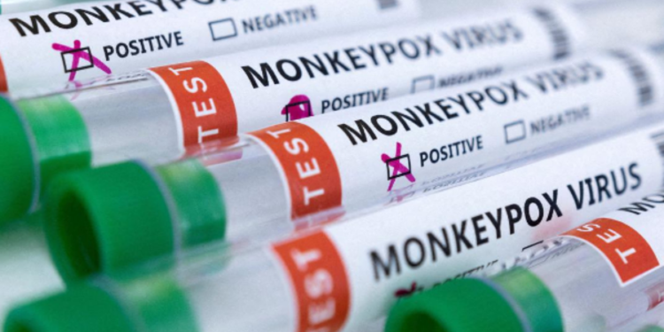 முதலாவது குரங்கம்மை மரணம் பதிவானது!