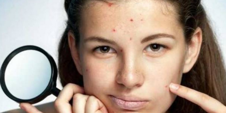 முகத்தில் ஏற்ப்படும் சுருக்கங்களை போக்குவது எப்படி?