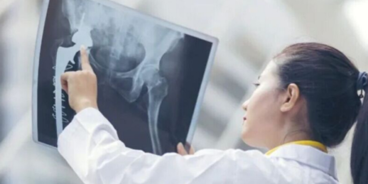 எலும்பு புற்றுநோயின் அறிகுறிகள்