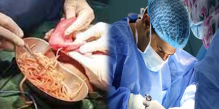 வயிறு வலியால் துடித்த சிறுவனின் வயிற்றில் இருந்து மீட்க்கப்பட்ட பெருந்தொகையான புழுக்கள்!