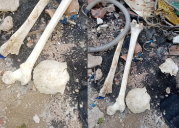 முல்லைத்தீவு காணி ஒன்றிலிருந்து மனித எச்சங்கள் மீட்பு!