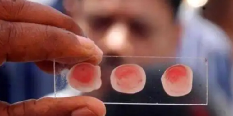 தங்க ரத்தம் பற்றி அறிந்துள்ளீர்களா?