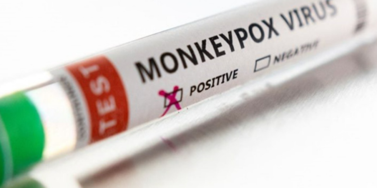 இலங்கையில் அடையாளம் காணப்பட்ட  குரங்கு அம்மை தொற்றாளர் குறித்து வெளியாகியுள்ள செய்தி!