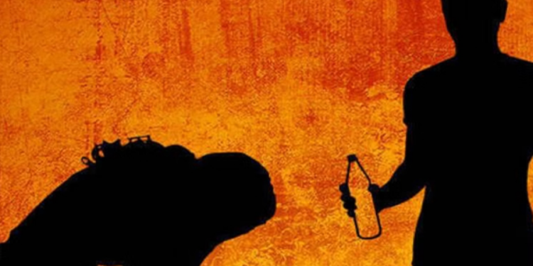 மகளின் தலையில் அசிட் ஊற்றிய தந்தை!