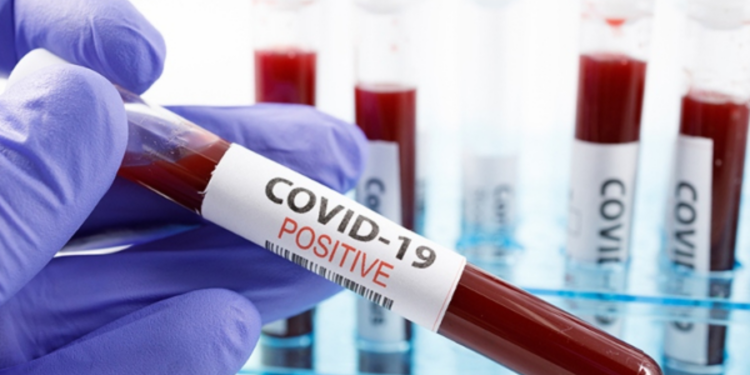 கொரொனோ தொற்றாளர்களின் எண்ணிக்கை மீண்டும் அதிகரிப்பு!