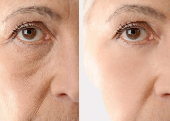 எப்பொழுதும் இளமையான தோற்றத்திற்கு