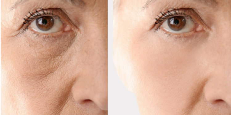 எப்பொழுதும் இளமையான தோற்றத்திற்கு