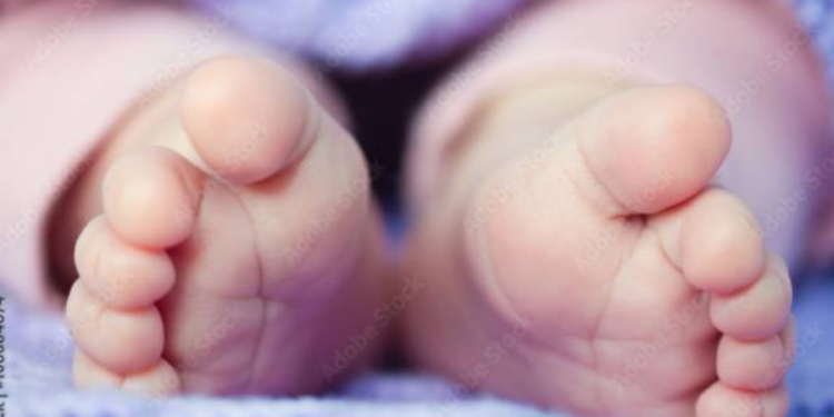 இரண்டு ஆணுறுப்புகளுடன் பிறந்த குழந்தை!