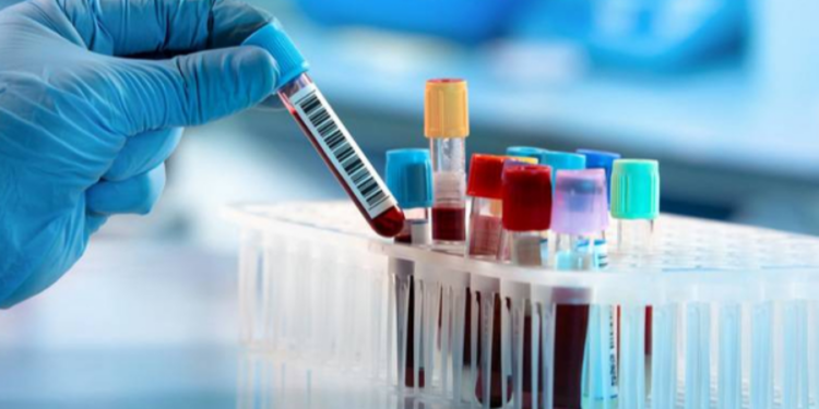 நாட்டில் தீவிரமடையும் நோய் தொற்று குறித்து மக்களிடம் விடுக்கப்பட்டுள்ள எச்சரிக்கை