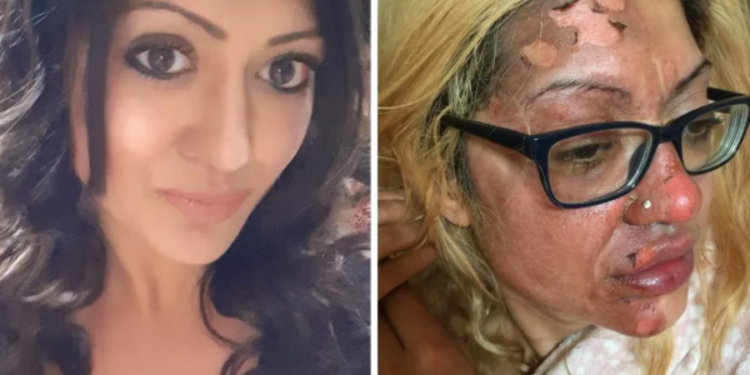 முட்டையால் பிரித்தானிய பெண்ணுக்கு நேர்ந்த சோகம்!