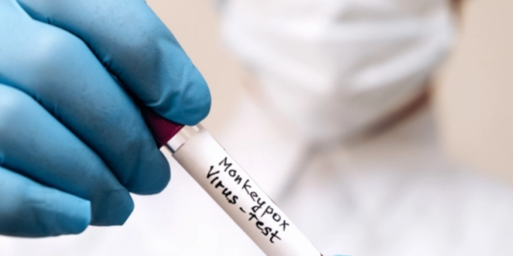 குரங்குக் காய்ச்சல் தொடர்பில் சுகாதாரத்துறை வெளியிட்டுள்ள முக்கிய அறிவிப்பு!