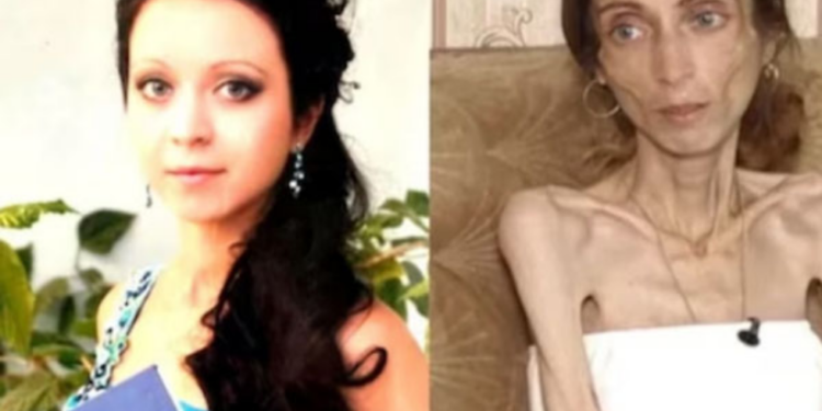 கணவர் சொற்கேட்டு டயட் இருந்த பெண்ணிற்கு நேர்ந்த சோகம்!