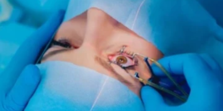 பெண்ணின் கண்களில் இருந்து உயிருடன் மீட்கபட்ட 60 புழுக்கள்!