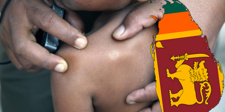 சிறுவர் தொழுநோயாளர்கள் அதிகளவில் உள்ள நாடுகளில் இலங்கையும் ஒன்று!