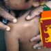 சிறுவர் தொழுநோயாளர்கள் அதிகளவில் உள்ள நாடுகளில் இலங்கையும் ஒன்று!