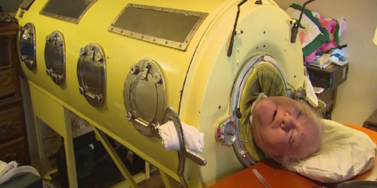 அமெரிக்காவின் இரும்பு நுரையீரல் மனிதன் காலமானார்!