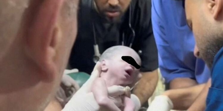 உயிரிழந்த பெண்ணிண் கருப்பையிலிருந்து மீட்கப்பட்ட சிசு