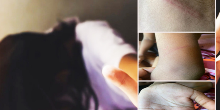 யாழில் இரண்டு மாணவிகளை தாக்கிய ஆசிரியை