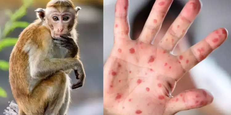 இந்தியாவில் ஒருவருக்கு குரங்கு காய்ச்சல் தொற்று!