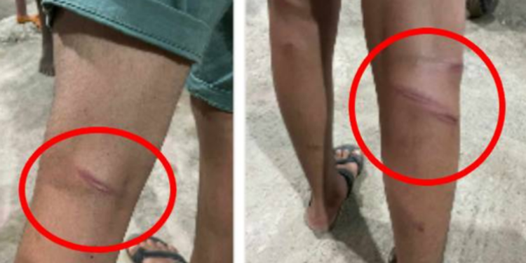 யாழில் மாணவனை மூர்க்கத்தனமாக தாக்கிய ஆசிரியர்