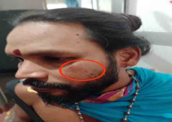 கிளிநொச்சியில் ஆலய குருக்கள் மீது கொடூர தாக்குதல்!