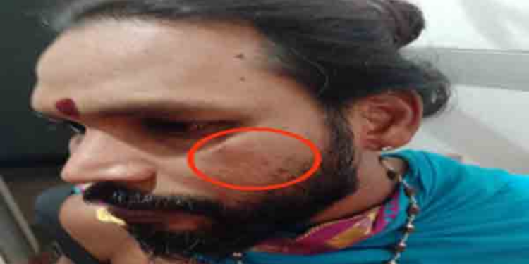 கிளிநொச்சியில் ஆலய குருக்கள் மீது கொடூர தாக்குதல்!