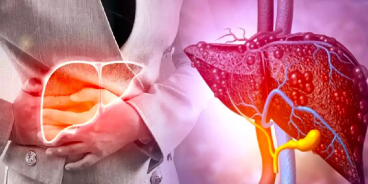 கொழுப்பு கல்லீரலால் பாதிக்கப்பட்டவரா நீங்கள்? நீங்கள் உண்ண வேண்டிய உணவுகள் இவை தான்!