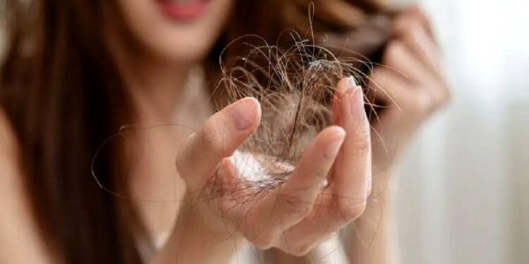 தலைமுடி உத்திரவுக்கு தீர்வு தரும்  எண்ணெய்