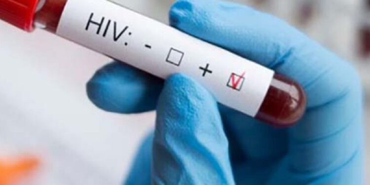 HIVயினால் இலட்சக் கணக்கானோர் பலியாக ட்ரம்ப் காரணமாகலாம் வெளியான தகவல்!